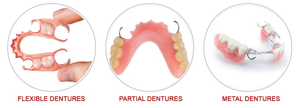 Metal Dentures Rosman NC 28772